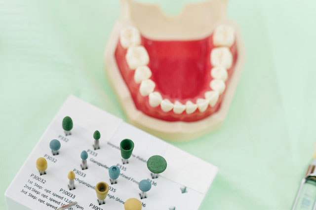 Dental Filling Procedure North Vancouver | Peak Dental Arts Clinic