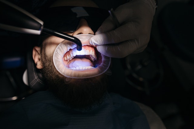 Dental Sealants | Peak Dental Arts