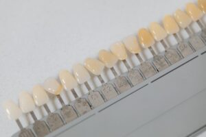 teeth whitening treatments