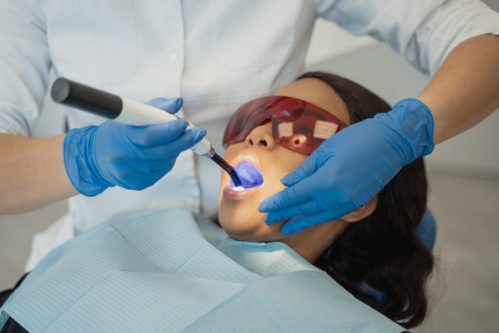 Root Canals Procedure North Vancouver | Peak Dental Arts Clinic